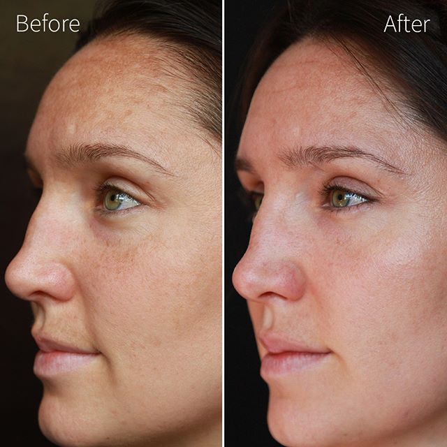 JoyÅme Skincare Anti Aging Serum Plexus Worldwide